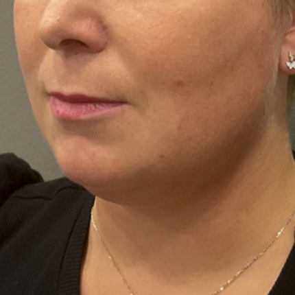 Cooltech-hage-før2-website