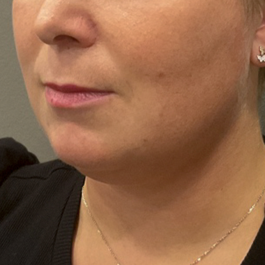 Cooltech-hage-før2-website