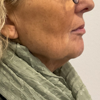 Website-nedadvendtemundviger-efter2