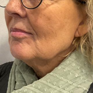 Website-nedadvendtemundviger-efter3