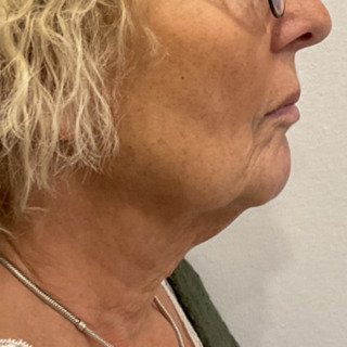 Website-nedadvendtemundviger-før2