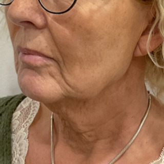 Website-nedadvendtemundviger-før3