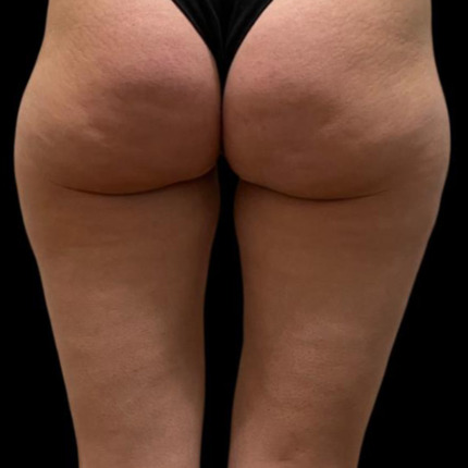 CeriX-sonekos-cell-foer