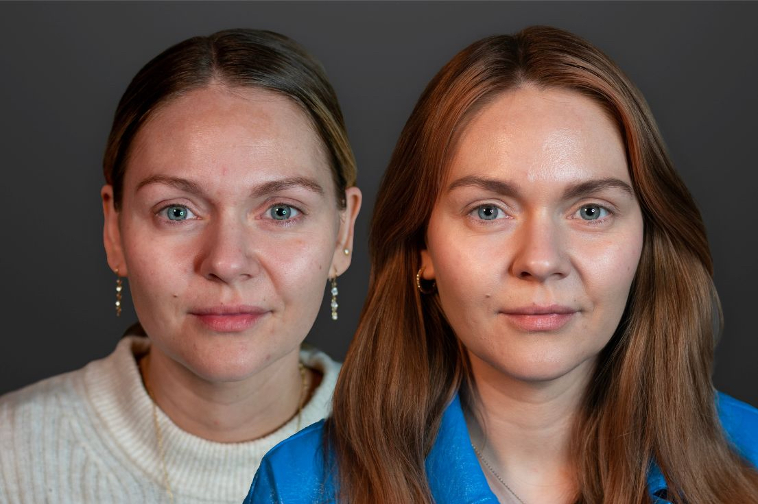 Blogindlæg forsidebillede - 17