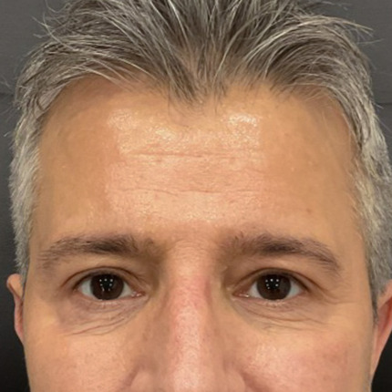 cerix-website-cosmelan-efter