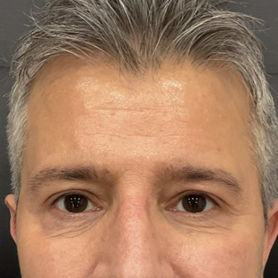 cerix-website-cosmelan-efter