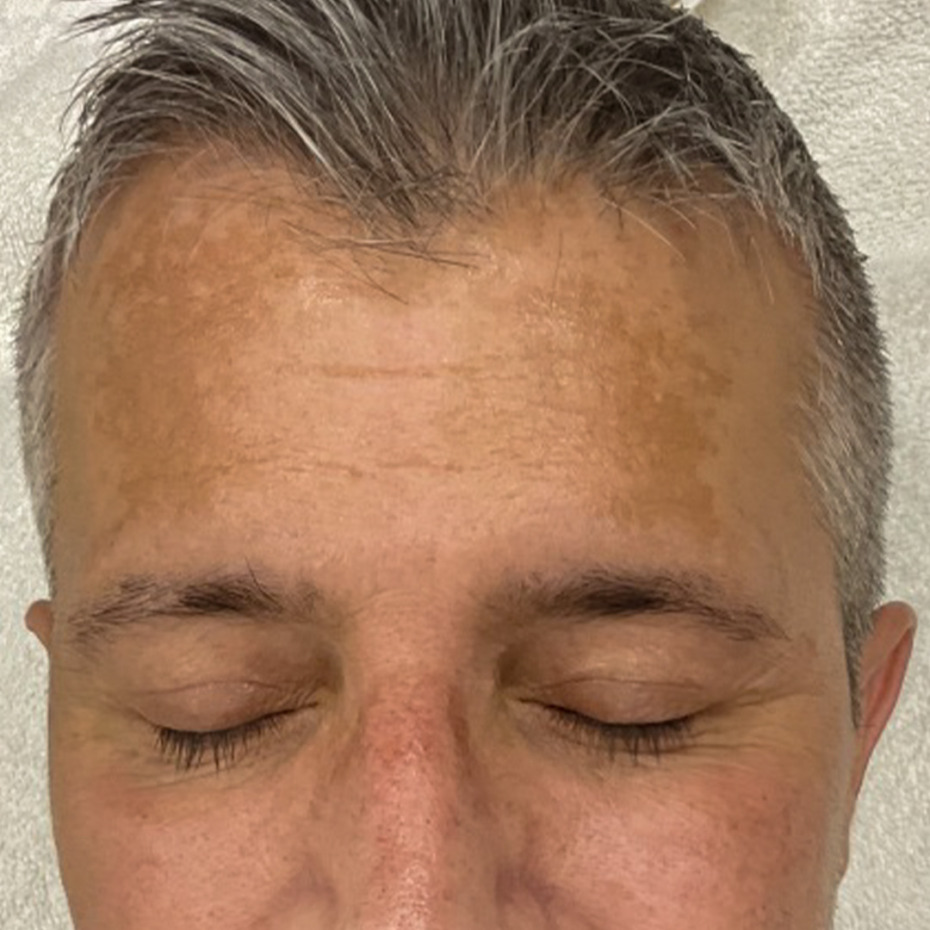 cerix-website-cosmelan-før