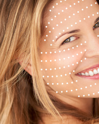 CeriX-skinbooster-ansigt