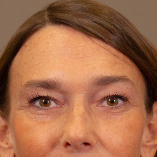 før-efter-marie-louise-før2