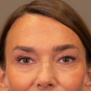 før-efter-marie-louise-web-efter2
