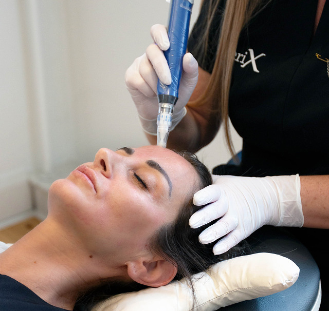 Skinpen-Image1 1