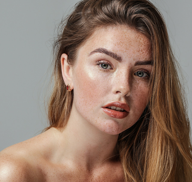 acnelan-peeling-header 1