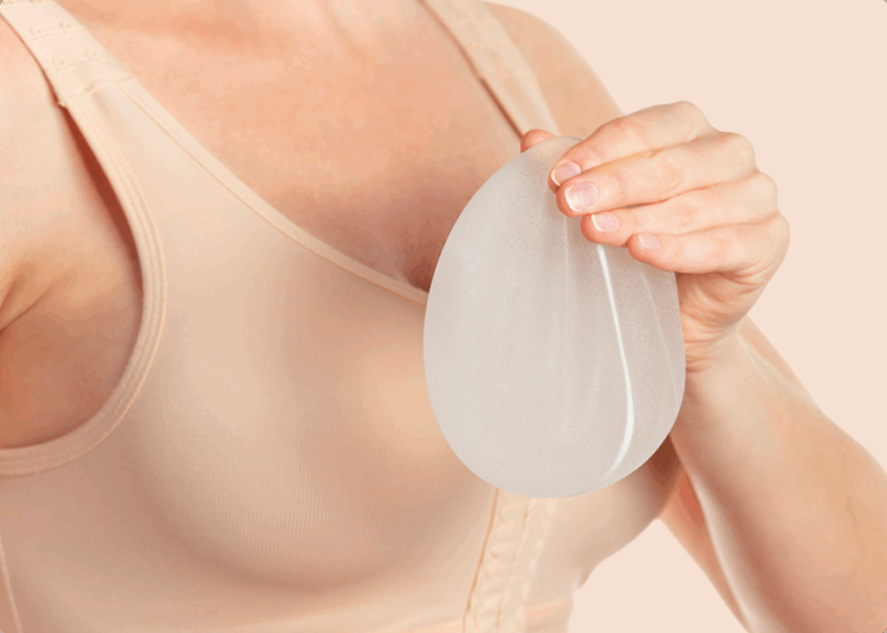 fjernelse-af-brystimplantater-image1 3 (1)