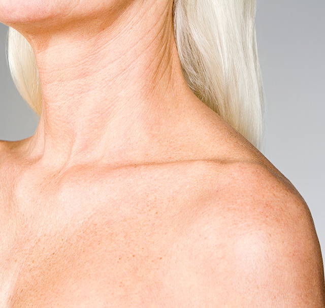 platysma-header 1