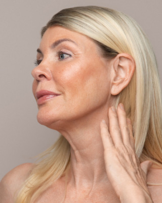 Botox behandlinger1