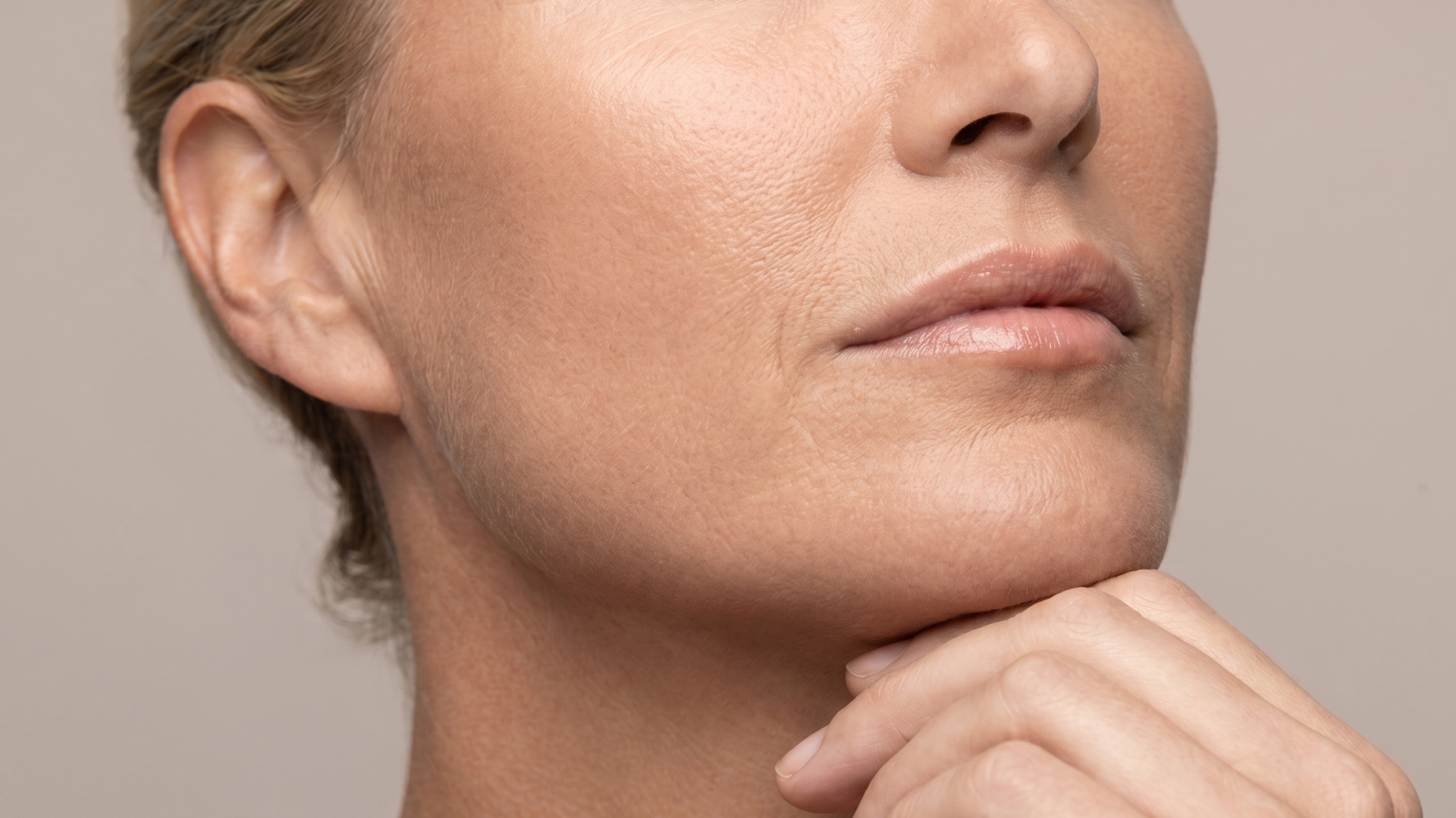 SkinPen microneedling1