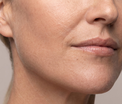 Skinbooster1